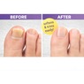 Foot Miracle Toenail Softening Cream, White, large