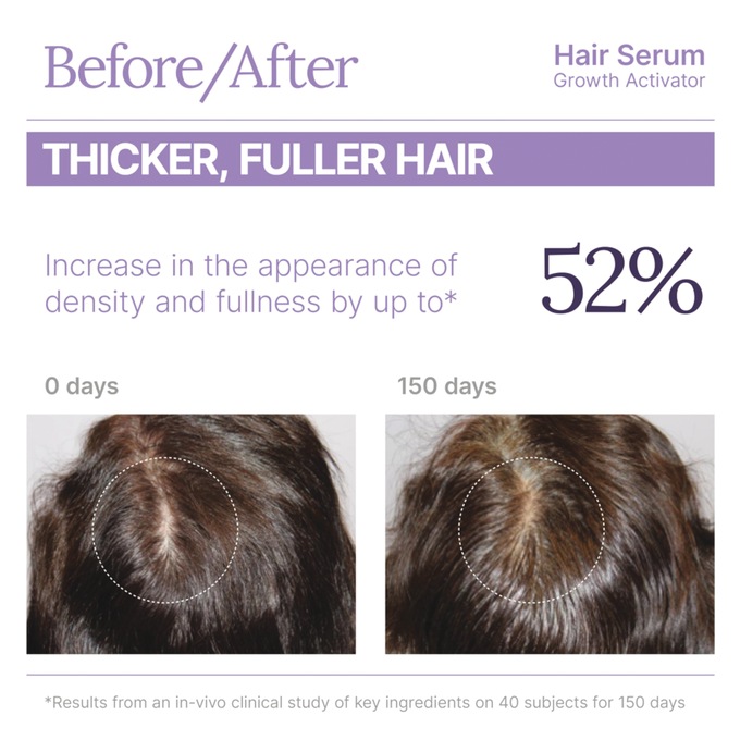 Keranique Hair Serum Growth Activator, , large