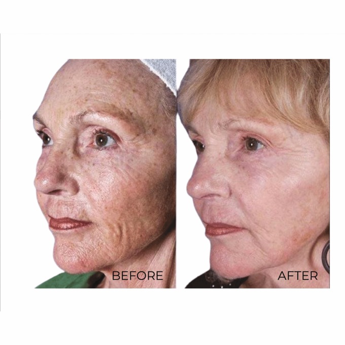 Age Spot Cream , , large